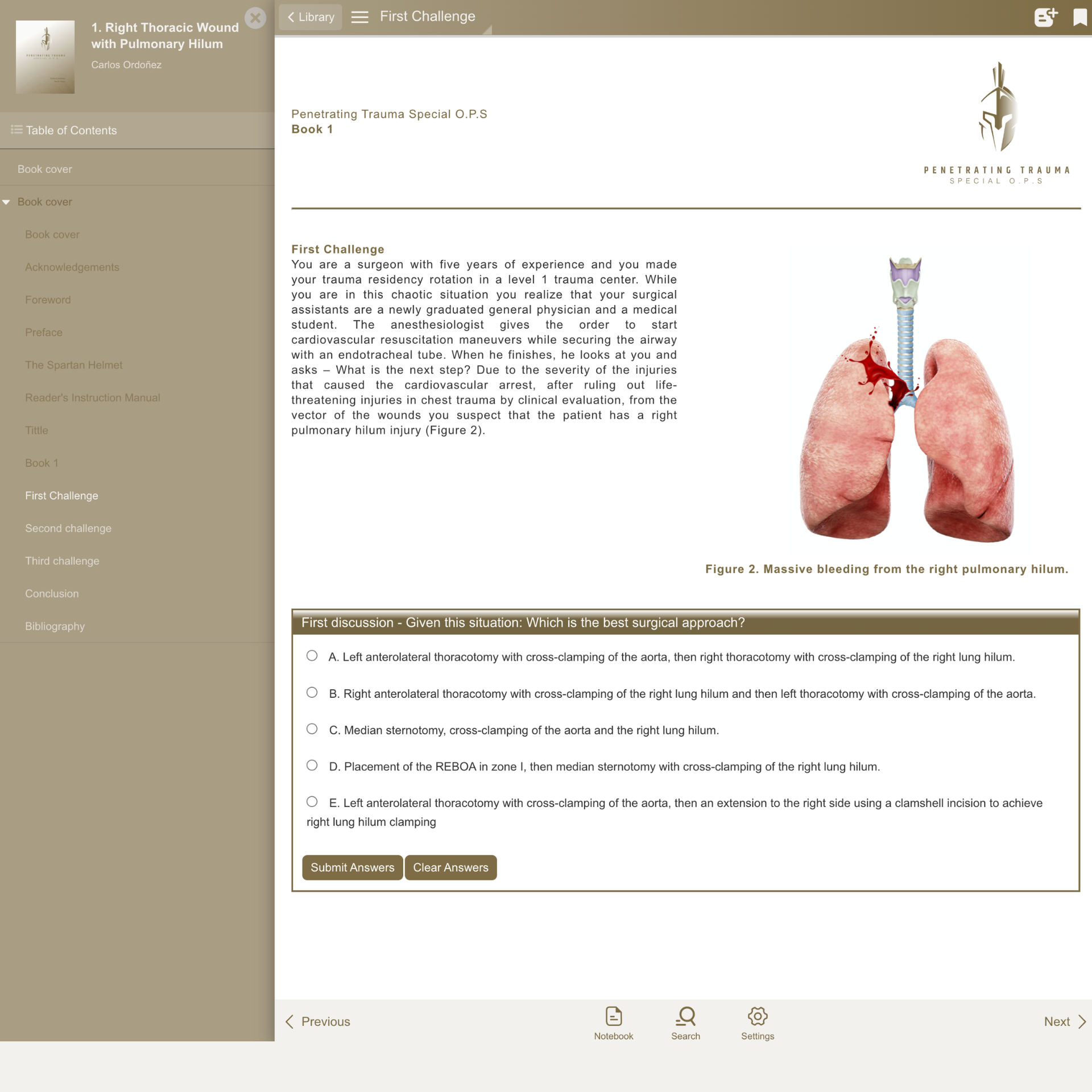 Case 1: Right Thoracic Wound with Pulmonary Hilum Injury